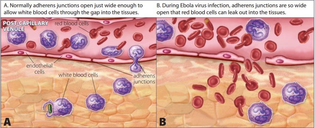 image ebola 2